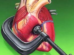 Heart in a vise showing the effects of stress on the cardiovascular system.
